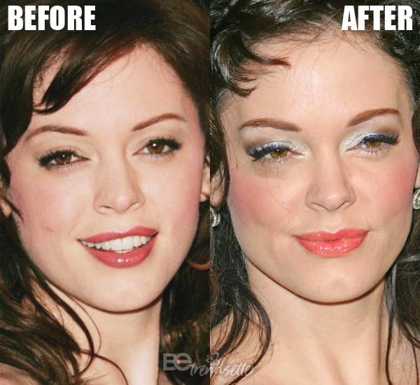 Rose Mcgowan Plastic Surgery Secrets Before And After