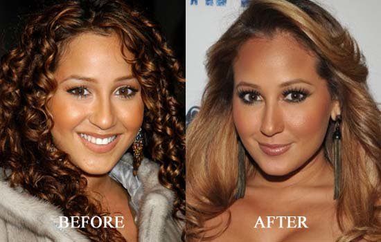 Adrienne Bailon Plastic Surgery: The Unresolved Mystery