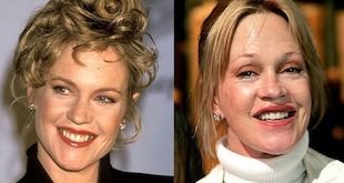 Melanie Griffith Plastic Surgery Gone Wrong or Just Haters?