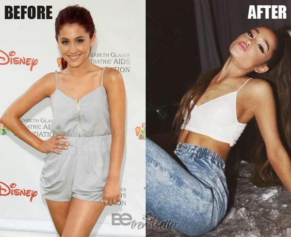 Sexy Ariana Grande Boobs - Ariana Grande Plastic Surgery REVEALED! Then And Now