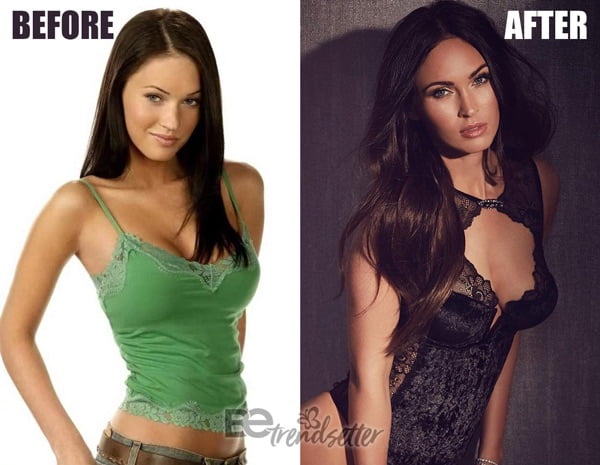 Megan Fox Before And After Plastic Surgery Boob Job And Lifting My