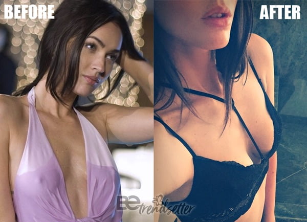 600px x 434px - Megan Fox Plastic Surgery Before And After REVEALED!