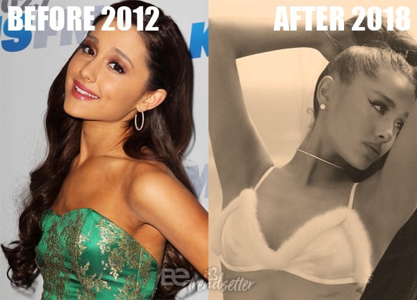 Ariana Grande Big Tits Porn - Ariana Grande Plastic Surgery REVEALED! Then And Now