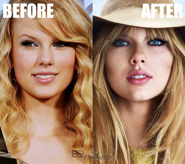 Taylor Swift Plastic Surgery Mystery SOLVED!