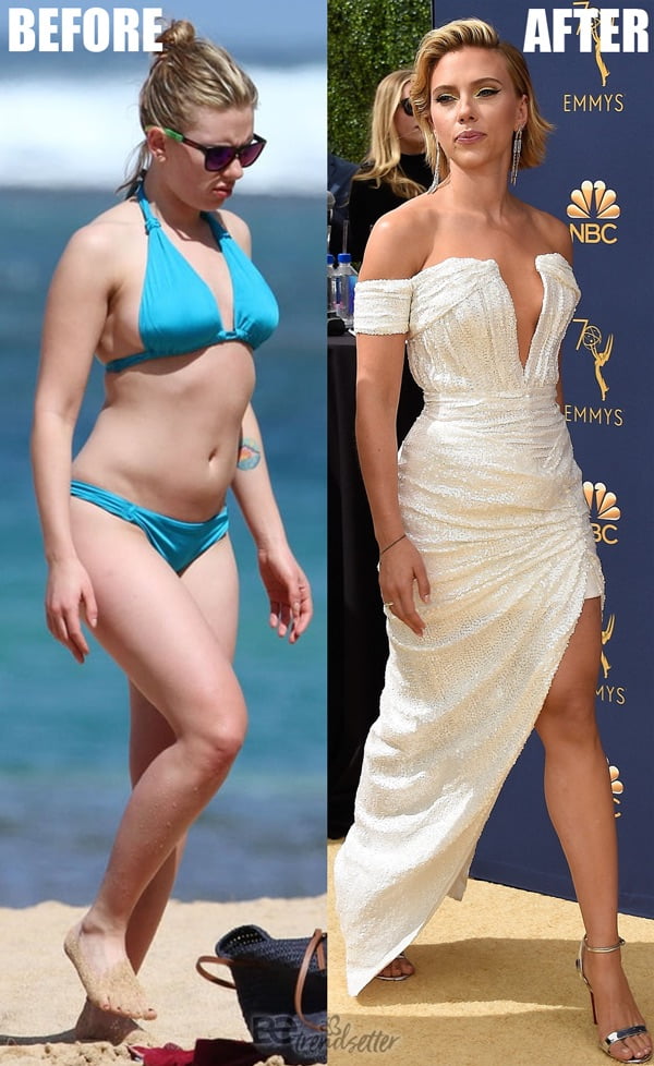 Scarlett Johansson Plastic Surgery Breast Reduction Before