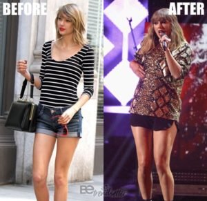 Taylor Swift Plastic Surgery Mystery SOLVED!