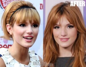 Bella Thorne Plastic Surgery Secrets! Before And After